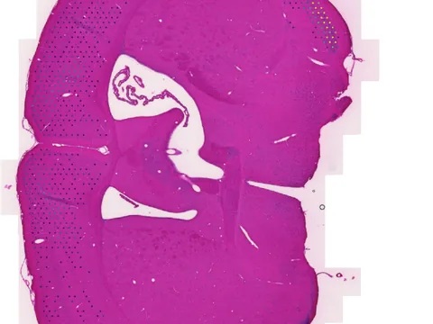 Mouse brain preview