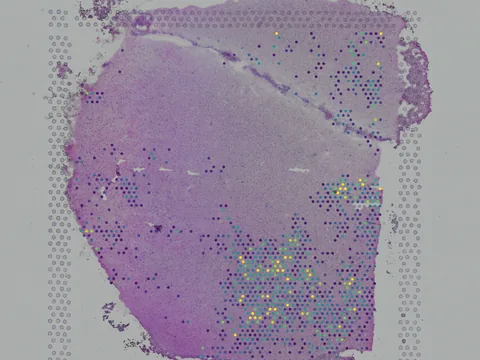 Human brain preview