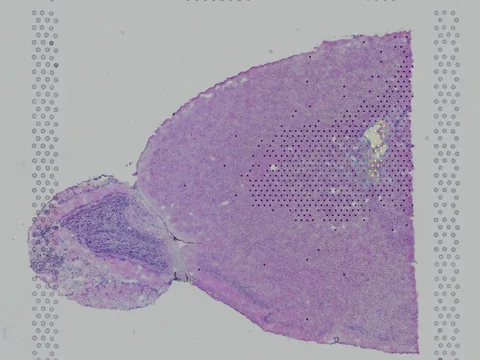 Mouse brain preview