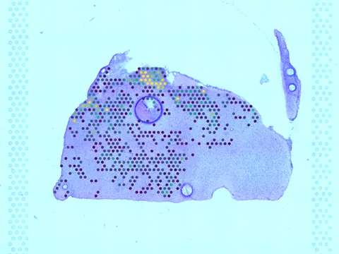 Mouse brain preview