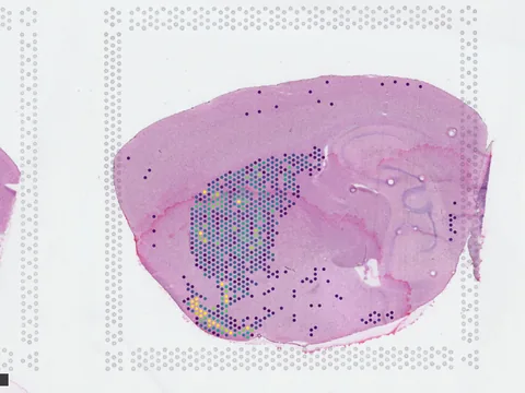 Mouse brain preview