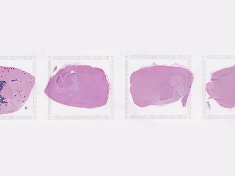 Mouse brain preview