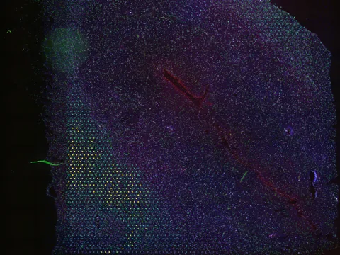 Human brain preview