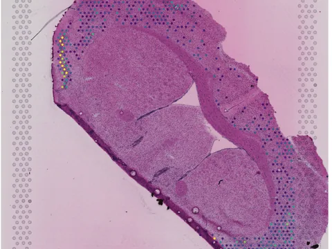 Mouse brain preview
