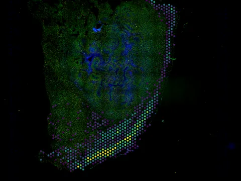 Mouse brain preview