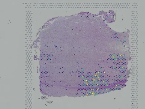Human brain preview