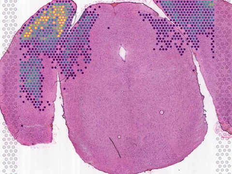 Mouse brain preview