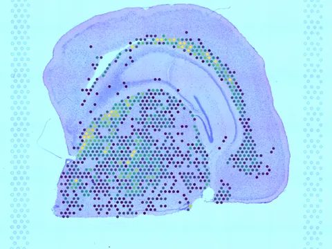 Mouse brain preview