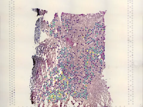 Human brain preview