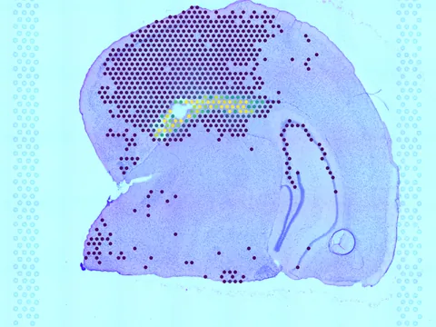 Mouse brain preview