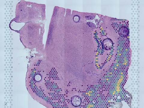 Mouse brain preview