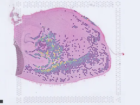 Mouse brain preview