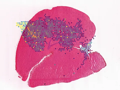Mouse brain preview