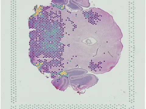 Mouse brain preview