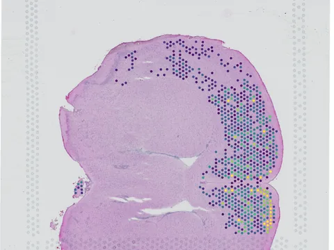 Mouse brain preview