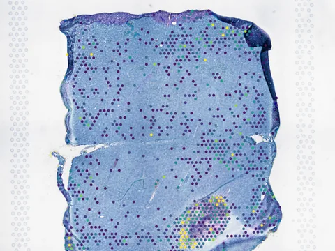 Human brain white matter preview