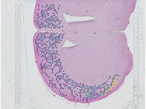 Mouse brain preview