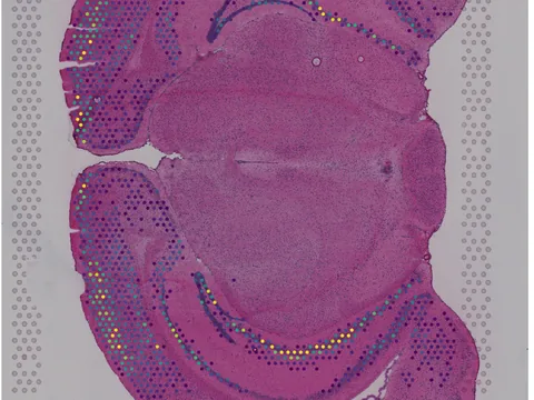 Mouse brain preview