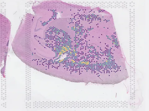 Mouse brain preview