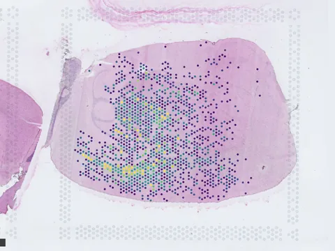 Mouse brain preview