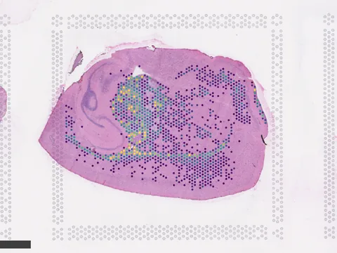 Mouse brain preview
