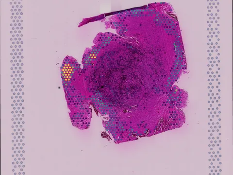 Human brain preview