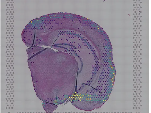 Mouse brain preview