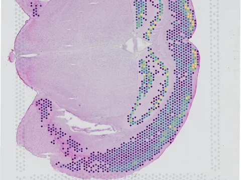 Mouse brain preview