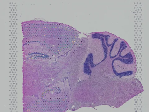 Mouse brain preview