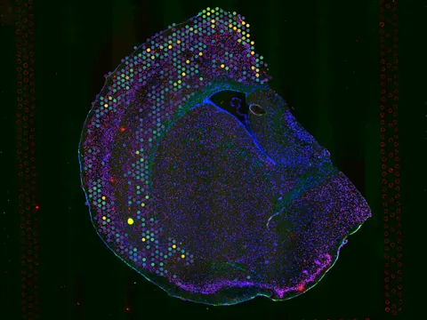 Mouse brain preview
