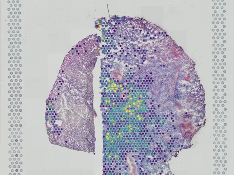 Human brain preview