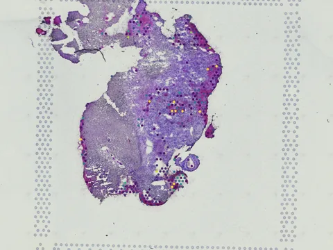Human brain preview