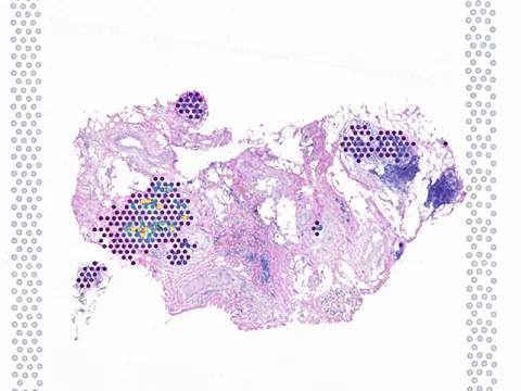 Human breast preview