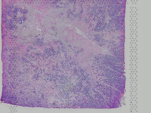 Human breast preview
