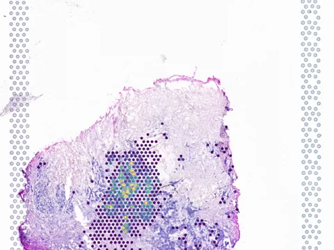 Human breast preview