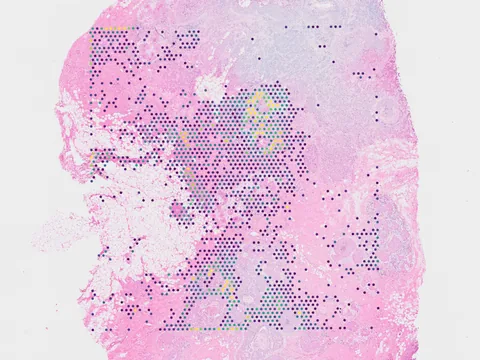 Human breast preview