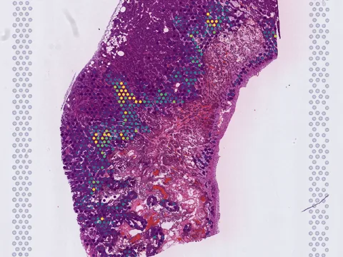 Mouse breast preview
