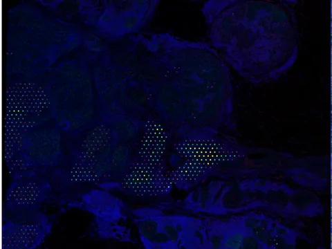 Human breast preview