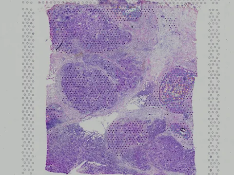 Human breast preview