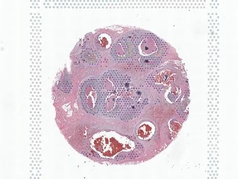 Human breast preview