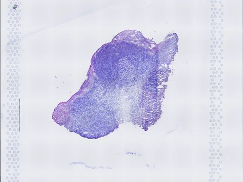 Mouse breast preview