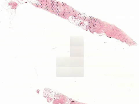 Human breast preview