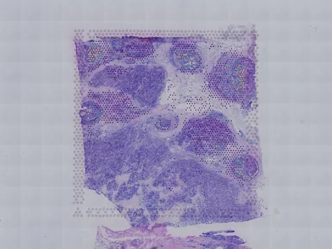 Human breast preview