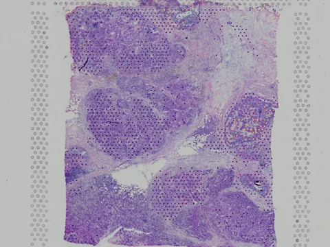 Human breast preview