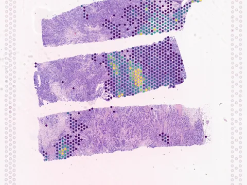 Human breast preview