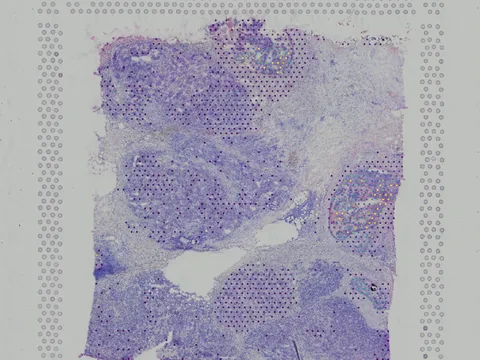 Human breast preview