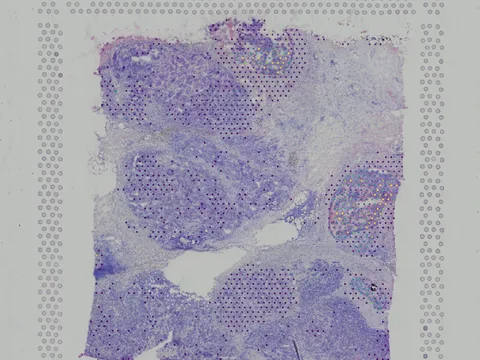 Human breast preview