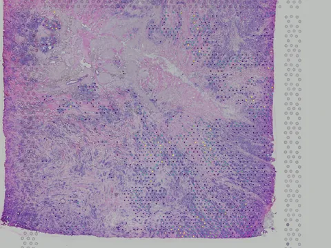 Human breast preview