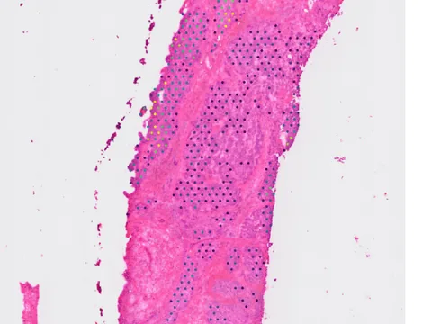 Human breast preview
