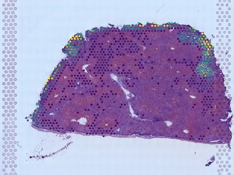 Human caudate lobe of liver preview